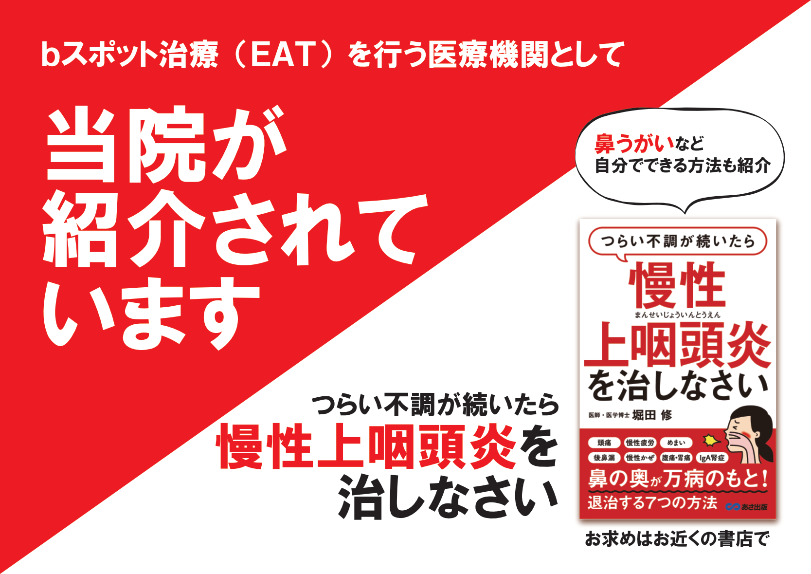 青梅駅前耳鼻咽喉科 Jr青梅線青梅駅前の耳鼻科 Eat Bスポット療法 のご案内